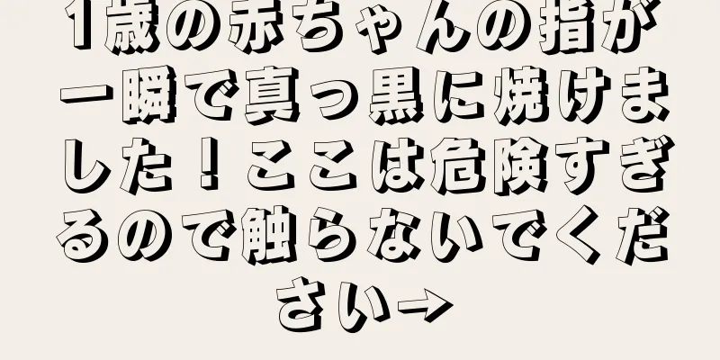 1歳の赤ちゃんの指が一瞬で真っ黒に焼けました！ここは危険すぎるので触らないでください→