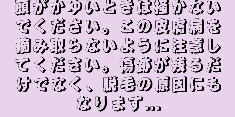 頭がかゆいときは掻かないでください。この皮膚病を摘み取らないように注意してください。傷跡が残るだけでなく、脱毛の原因にもなります...