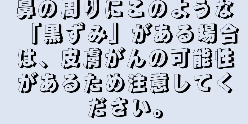 鼻の周りにこのような「黒ずみ」がある場合は、皮膚がんの可能性があるため注意してください。