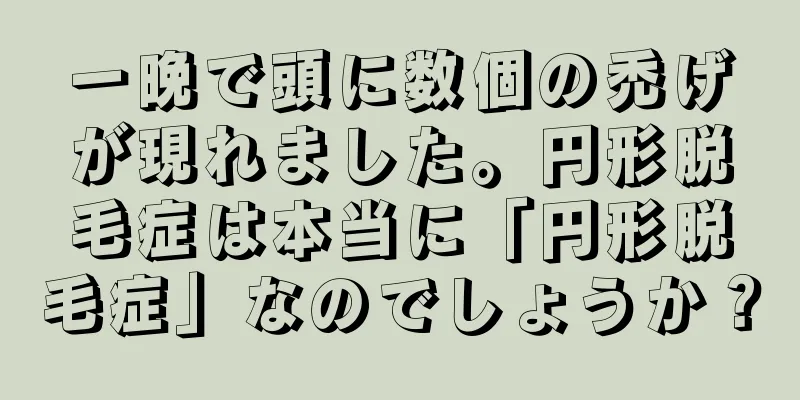 一晩で頭に数個の禿げが現れました。円形脱毛症は本当に「円形脱毛症」なのでしょうか？