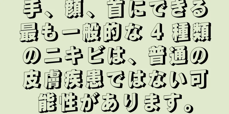 手、顔、首にできる最も一般的な 4 種類のニキビは、普通の皮膚疾患ではない可能性があります。